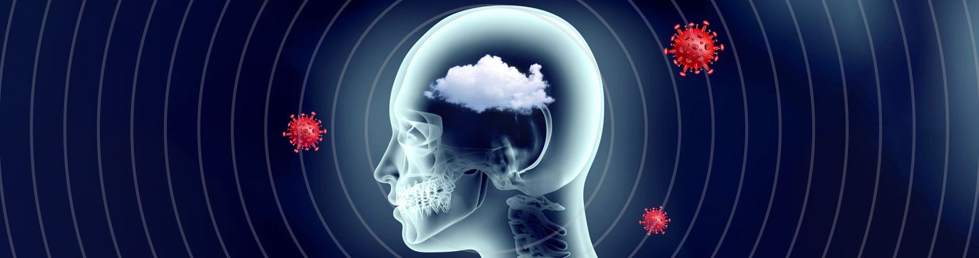 Brain Fog after Covid-19: Symptoms, Contributing Factors and Treatment