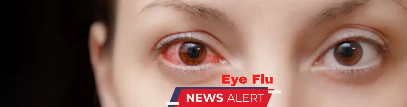 Eye Flu / Conjunctivitis Surge Alert: Identifying and Managing Symptoms