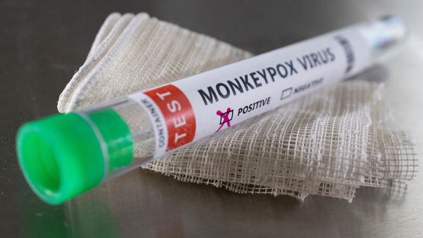 Monkeypox Virus: Preventive Measures and Home Remedies for the Symptoms