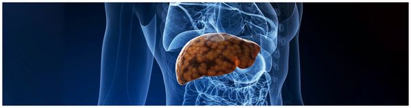 These Dietary Changes can Revert Your Fatty Liver